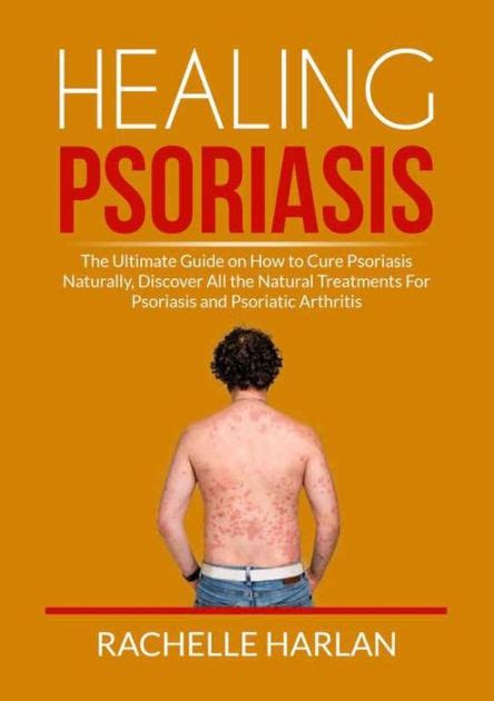 Healing Psoriasis The Ultimate Guide On How To Cure Psoriasis
