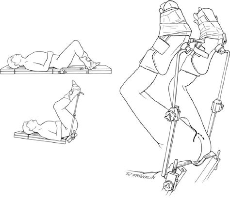Technique Of Placing A Patient In The Exaggerated Lithotomy Position Download Scientific