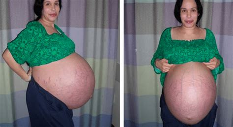 Meet The Mother Who Had 8 Children At Once Her Babies Look Extremely