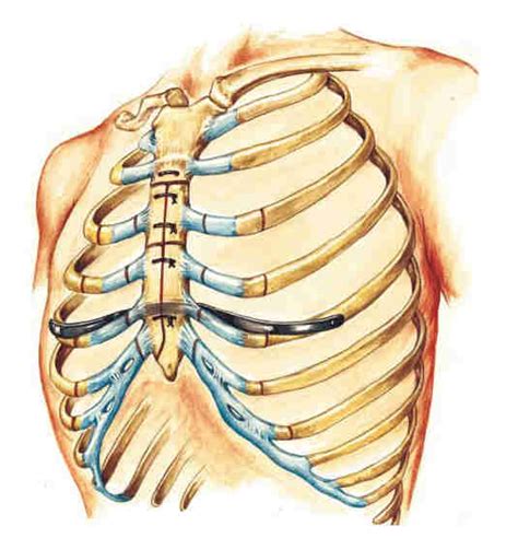 Pectus Excavatum: tecniche di correzione | MEDICITALIA.it