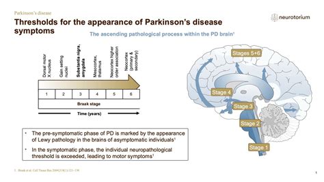 Parkinsons Disease Course Natural History And Prognosis Neurotorium