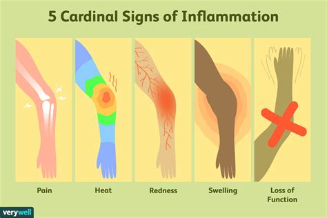 5 Cardinal Signs Of Inflammation 2022