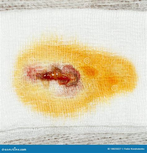 Stain Of Pus Blood And Iodine Royalty Free Stock Photography Image