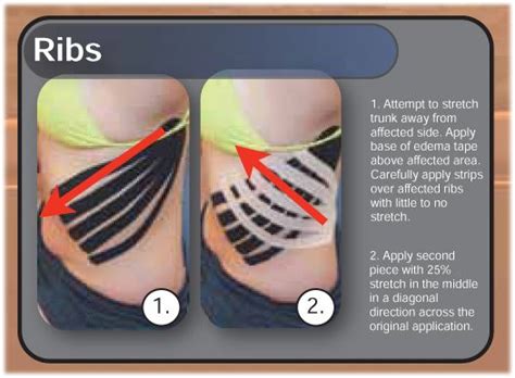 Kinesiology Taping Instructions For Edema In The Ribs From Rocktape