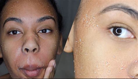Dry Skin On Eyes Nose Ear Hands Or Legs Remedies
