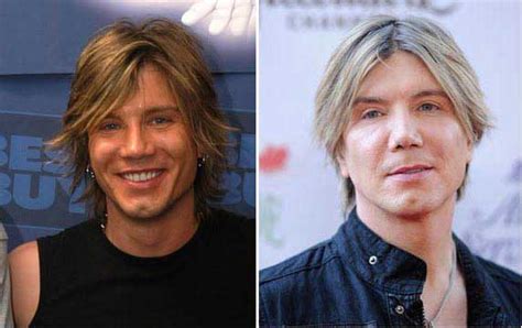 John Rzeznik Plastic Surgery Rumors Did He Really Has The Surgery