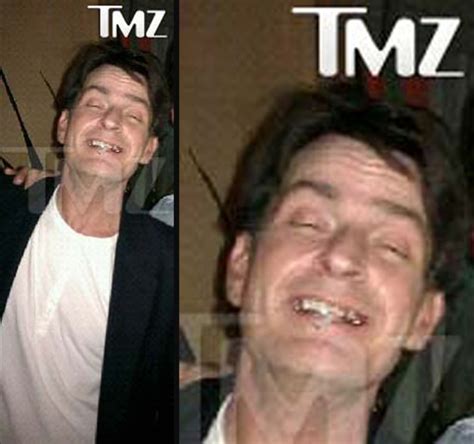 Charlie Sheen S Mouthful Of Gold Teeth