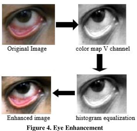 Figure 1 From Anemia Detection Using Image Processing Semantic Scholar