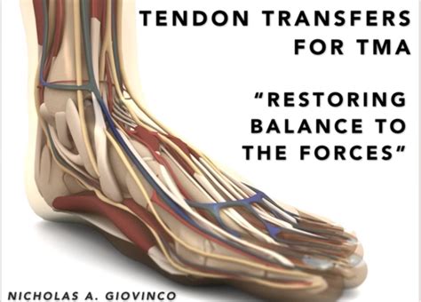 Anterior Tibial Tendon Transfer 3d Animation And How To Dfcon15 Df Blog