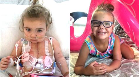 Girl Born With Aortic Narrowing Defect Thrives After Heart Transplant