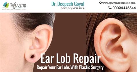 Earlobe Repair Is A Surgical Procedure For People With Stretched