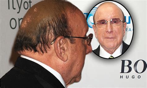 The powder instantly covers bald spots, thinning, and patchiness across your temples, part, crown, and sides. Clive Davis covers bald patch with badly applied 'spray-on ...
