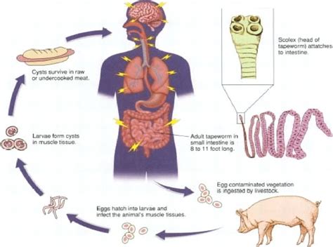 Life Cycle Tapeworm In Humans