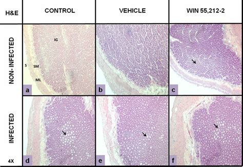 Morphology Of Duodenum Hematoxylin And Eosin Staining Hand 4× In