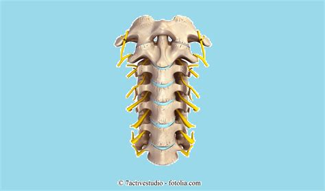 Bandscheibenvorfall was ist das genau? Operation bei lumbosakralem Bandscheibenvorfall (L5-S1 ...