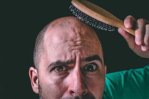 Table of contents keppra for the treatment of persons with dementia drug interactions with levetiracetam (keppra) How Long Does it Take to Go Bald? The Answer May Surprise You