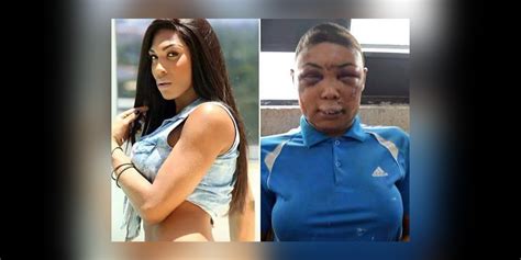 Somostodasveronica Trans Woman Beaten In Brazilian Prison Al Jazeera