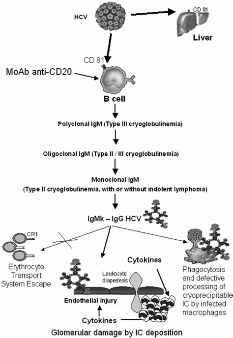 Pathogenesis Of Cryoglobulinaemic Nephritis And Rationale For Rituximab