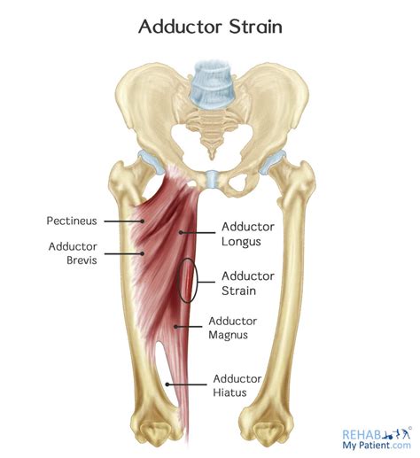 Hip Adductor Strain Rehab My Patient