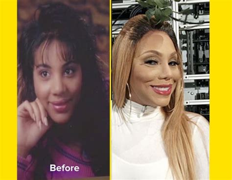 Tamar Braxton Before And After Plastic Surgery Mto News
