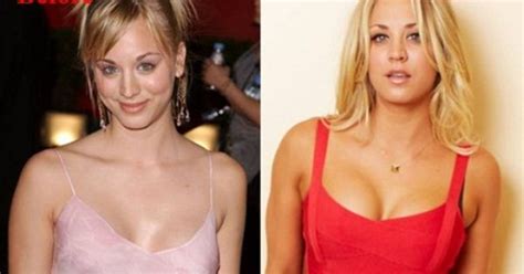 Kaley Cuoco Plastic Surgery Before And After Plastic Surgery News