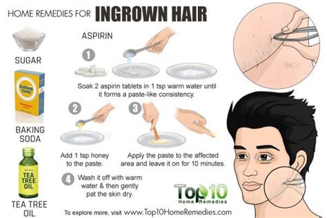 49 Hq Photos Ingrown Hairs Armpit How To Treat Ingrown Hairs