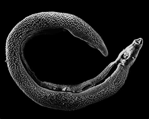 Schistosoma Flatworm Genus Britannica
