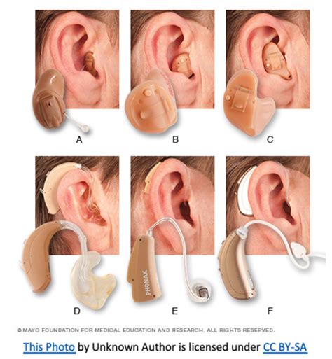 Questions To Ask Before You Buy Hearing Aids Clearlife Hearing Care