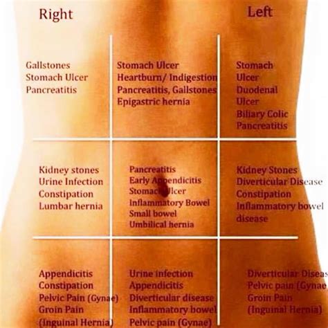 Stomach Pain Chart To Understand What Your Pain Tells You