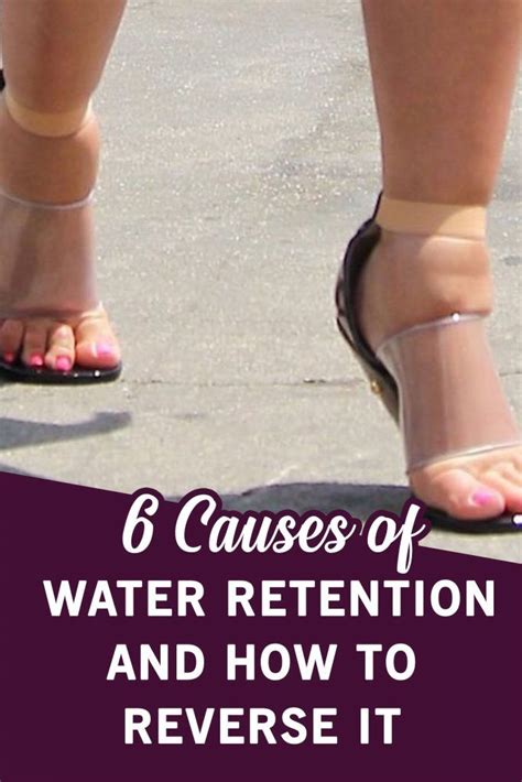 6 Causes Of Water Retention And How To Reverse It Water Retention