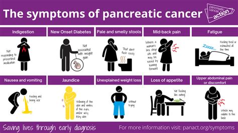 Common Misdiagnosis Of Pancreatic Cancer Pancreatic Cancer Signs