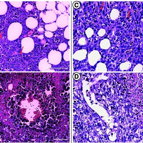 Vascular Endothelium Of Liver Lung And Tumor Photomicrographs Were Download Scientific