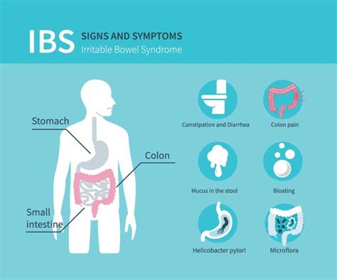 Irritable Bowel Syndrome Northern Virginia Gastroenterology