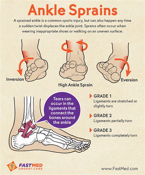 Do I Have A Sprained Ankle Infographic Fastmed