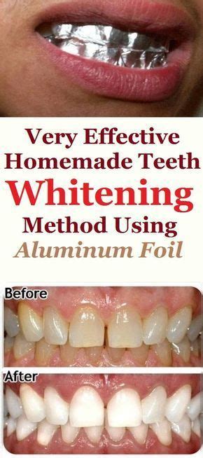 The 25 Best Homemade Teeth Whitening Ideas On Pinterest