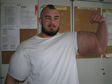Synthol Users Look Completely Abnormal