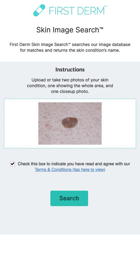 Artificial Intelligence Ai Dermatology Skin Image Search™ Free