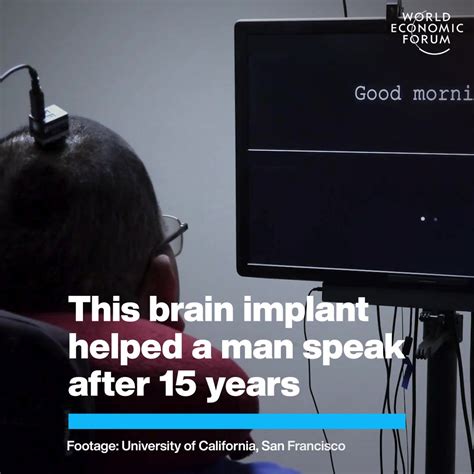 this brain implant helped a man speak after 15 years world economic forum