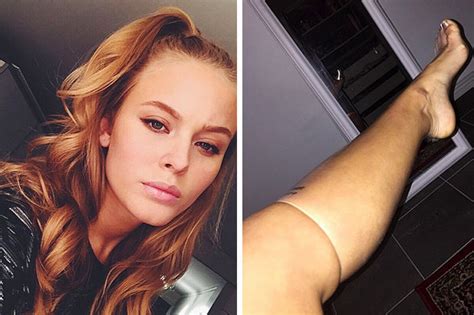 Swedish Singer Zara Larsson Posts Viral Instagram Photo Of Leg In A
