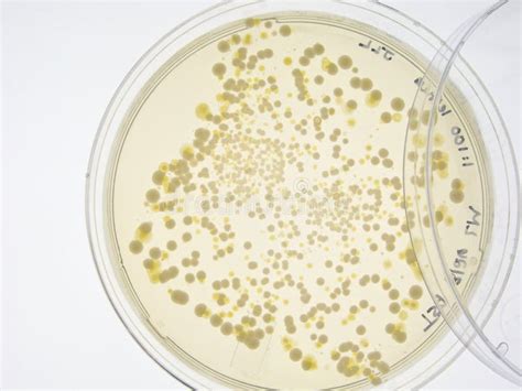 Bacterial Colonies On Agar Plate Stock Photo Image Of Cells Medical