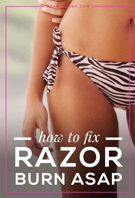 How To Reverse Razor Burn Asap Razor Burns Razor Burn Remedies Burn Remedy