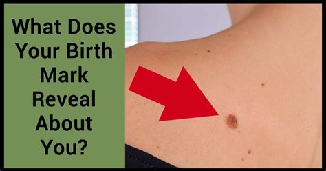 What Does Your Birth Mark Reveal About How You Were Killed In Your Past