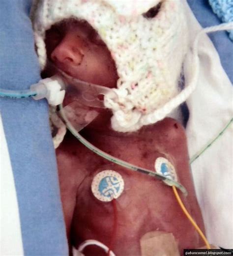 Cara kira usia kandungan online. Ajaib,Bayi Ini Lahir Pada Usia Kandungan 5 Bulan - Gaban Comel