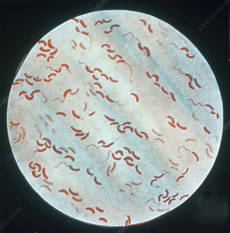 Vibrio Cholerae Stock Image C0076088 Science Photo Library