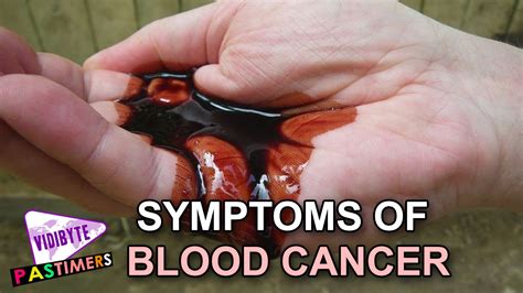 What Are The Symptoms Of Blood Cancer Health Tips Youtube