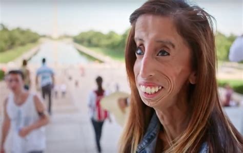 she was once called the world s ugliest woman—now she s living your dreams