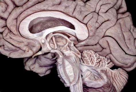 Medial Perspective Of Partially Dissected Brainstem Diencephalon And Cerebellum Neuroanatomy