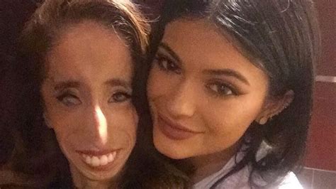 Kylie Jenner Joins Lizzie Velasquez Anti Bullying Campaign