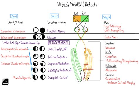 Dx Schema Visual Field Defects The Clinical Problem Solvers