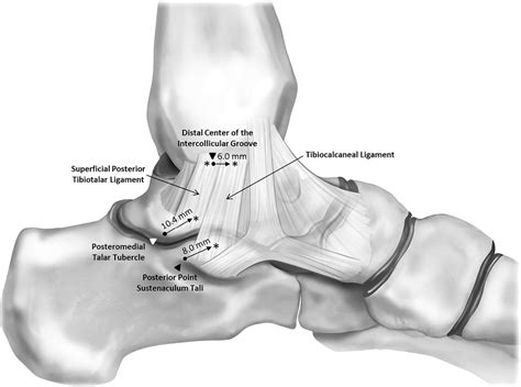 Figure 5 from The ligament anatomy of the deltoid complex of the ankle